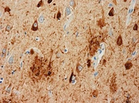 Illustration for article titled Can Science See Inside An NFL Player's Skull Before It's Too Late?
